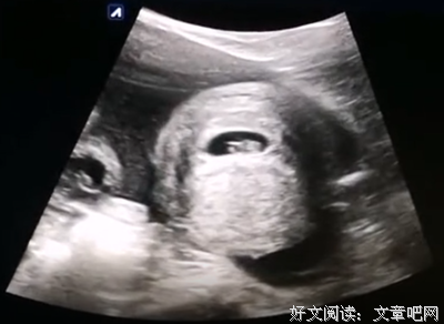 《九月怀胎》好看吗？经典观后感锦集