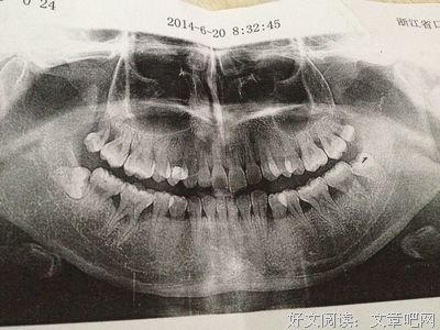《智齿》读后感锦集