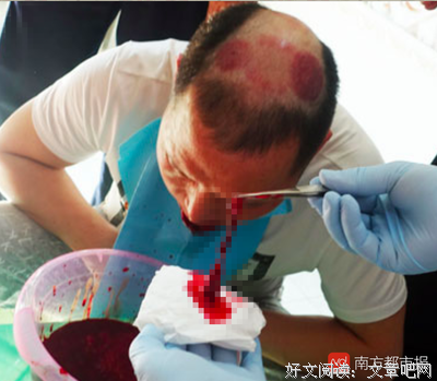 最全的刺血的名句
