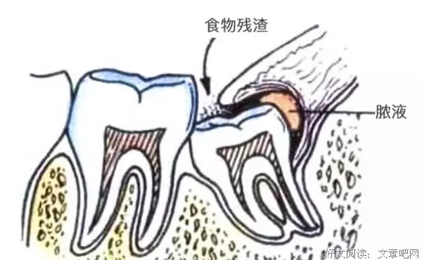 智齿经典读后感有感