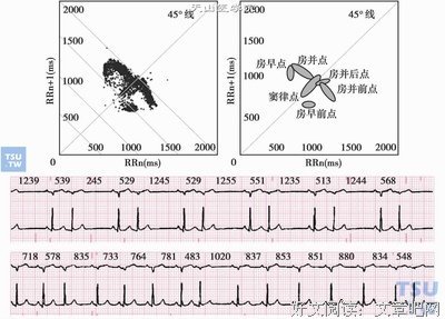 《心电图图解速成讲授》读后感精选