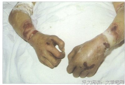 《血液循环》读后感100字