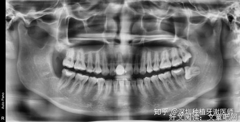 《智齿》名句欣赏大全