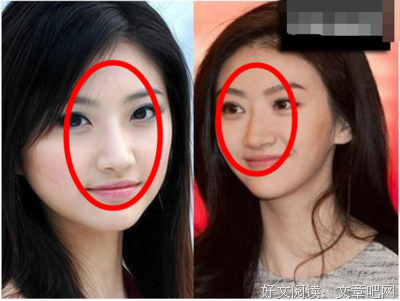 整容医生：说说跟女明星闹上热搜的绯闻