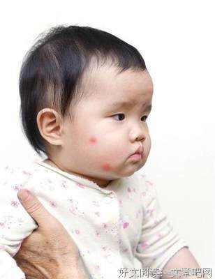 《为什么有的人特別招蚊子?》读后感摘抄
