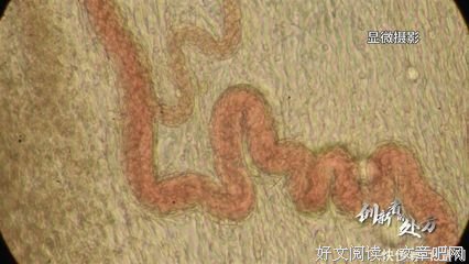 《创新者的处方》读后感摘抄