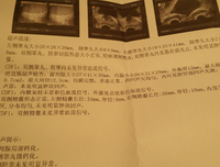 《邪症迷思（医学大神04）》读后感精选