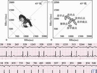 《心电图图解速成讲授》读后感精选