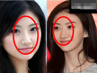 整容医生：说说跟女明星闹上热搜的绯闻