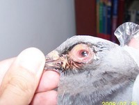 应对单眼伤风的点滴体会