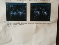老婆流产后，他恼了