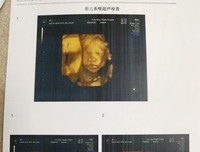  关于第一次见面，有个道理越早知道越好