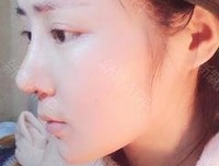 最全的《你耳软骨发炎了》好段摘抄