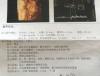 看不见的 男孩 子