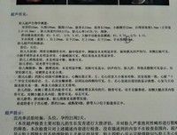 不要说，去做
