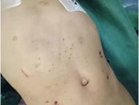 4岁女童遭继母剪掉嘴唇，打成颅内出血：儿童家暴，是时