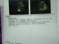 实录：老公去世那天，婆婆逼着怀孕4个月的我，做亲子鉴