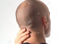 跪在别人脖子上的男人