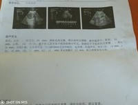 暗夜回声读后感100字
