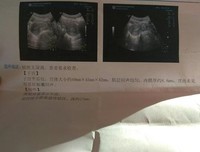 陪你走了一段没有结果的路，虽然不长但足够了