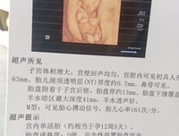 明明长得不丑，却总遭男生断联，你也遇到过吗？