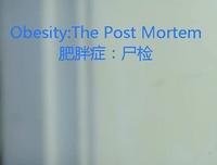 《解剖肥胖》好看吗？经典影评锦集