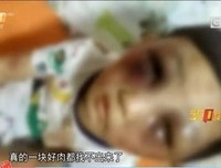 关于遍体鳞伤的名句摘抄