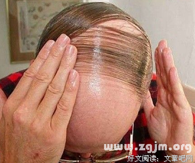  秃顶的人生不需要解释