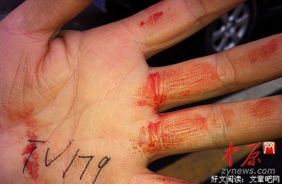受伤的小野猪