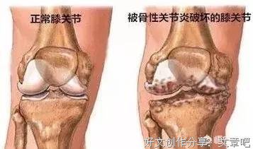 不知道大家发现没有，老人愈疼痛，老年愈指望不上谁