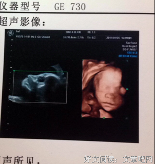 今日份的小感动