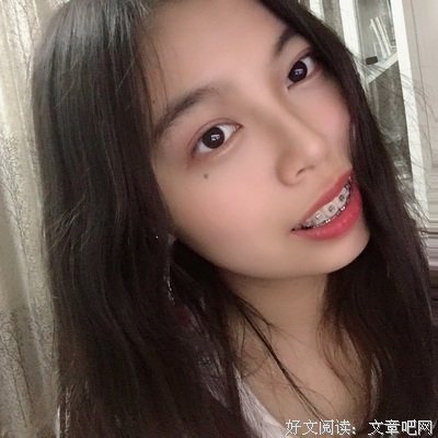 戴牙套