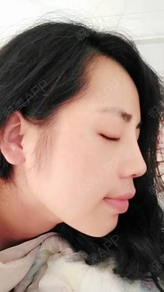 朝槿的宽爱